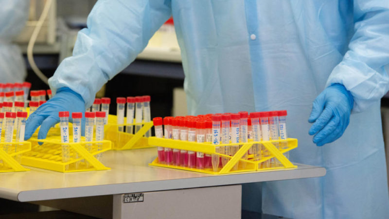 Aggiornamento situazione Coronavirus 16 giugno 2020: zero casi nuovi e zero decessi