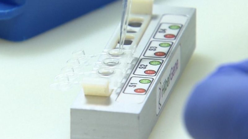 1 decesso, 312 nuovi contagi. 167 nuovi guariti. Vaccinazioni vicine a quota 36.000. Poco meno di 3.700 tamponi