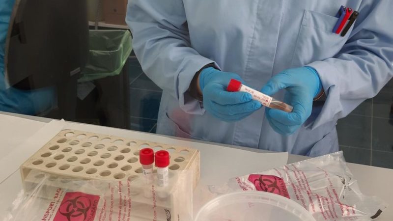 3 decessi, 70 nuovi contagi, oltre 170.000 vaccinazioni, 119 nuove guarigioni