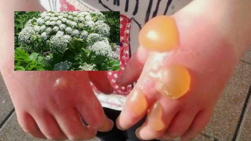 Allarme per la Panace di Mantegazza: “Non toccate questa pianta”.